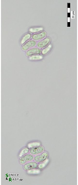 Scenedesmus obtusus
