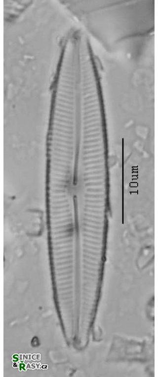 Cymbopleura incertiformis