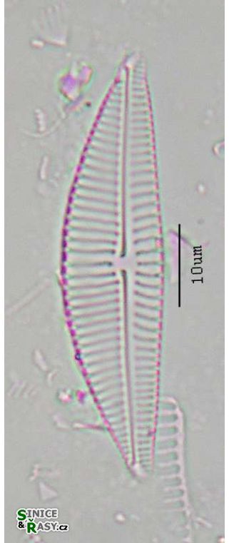 Encyonema hebridica