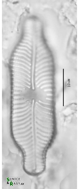 Placoneis abiskoensis