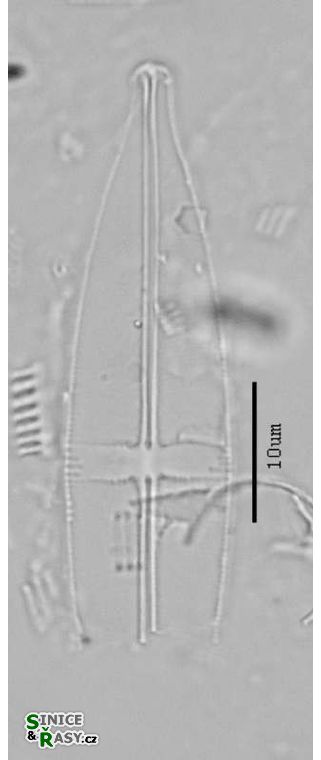 Stauroneis anceps