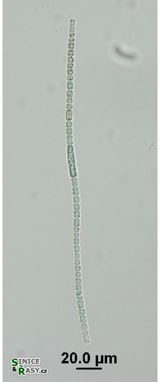 Anabaena augstumalis