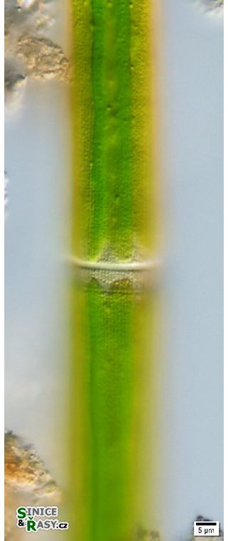 Closterium lineatum var. elongatum