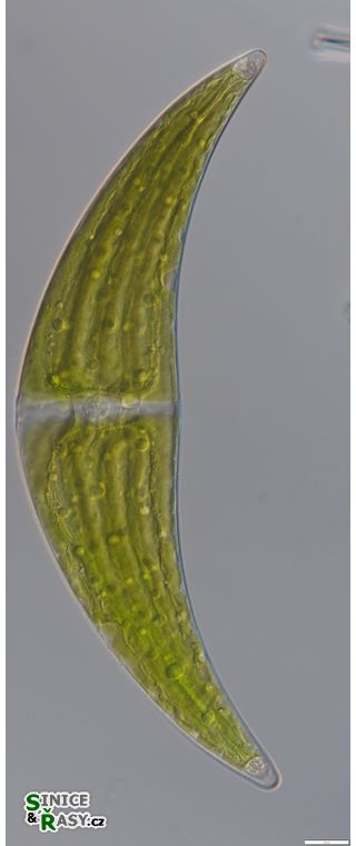 Closterium submoniliferum