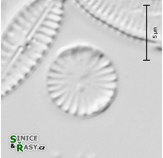 Cyclotella atomus