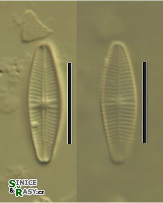 Achnanthidium minutissimum