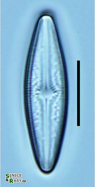 Brachysira brebissonii