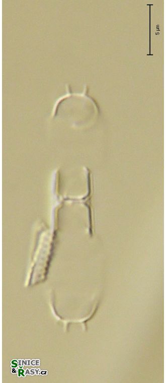Skeletonema potamos