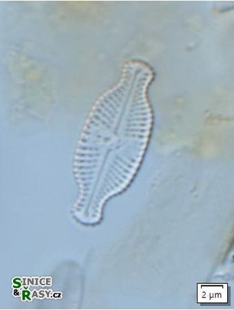 Luticola ventriconfusa