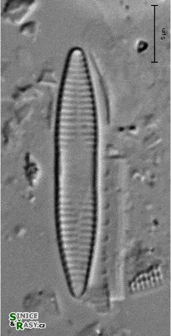 Fragilaria capucina
