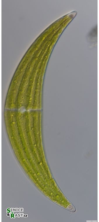 Closterium submoniliferum