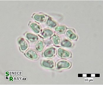 Crucigeniella apiculata