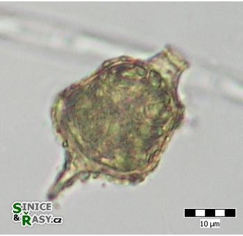 Strombomonas acuminata