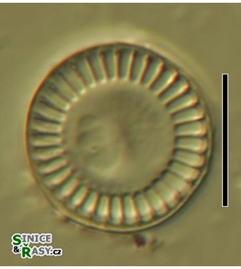 Cyclotella meneghiniana