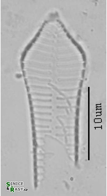 Fragilaria dilatata