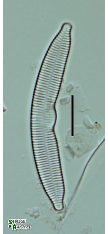 Fragilaria arcus