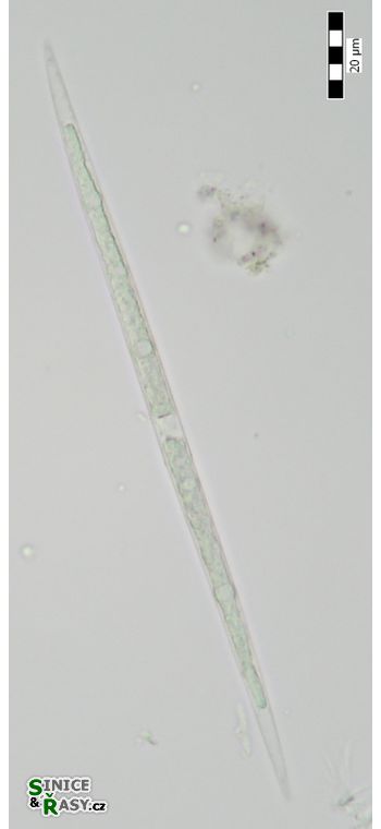 Closterium limneticum