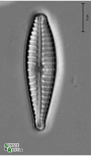 Gomphonema parvulum