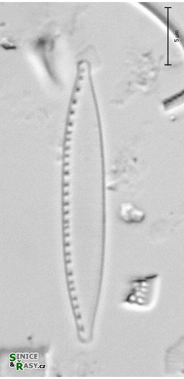Nitzschia cf. supralitorea