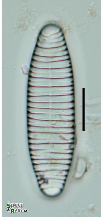 Diatoma vulgaris