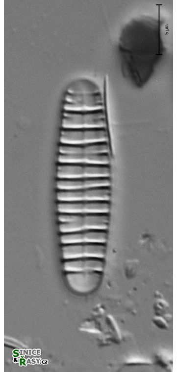 Diatoma  vulgaris