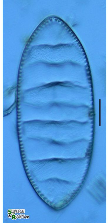 Cymatopleura eliptica