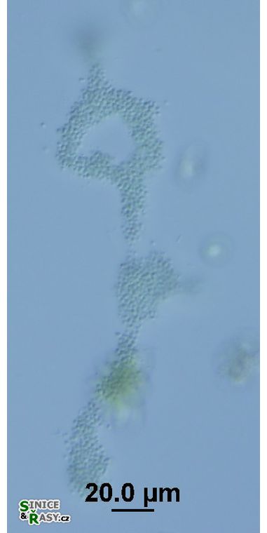 Aphanocapsa stagnalis