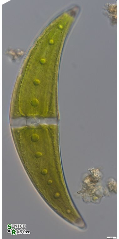 Closterium moniliferum