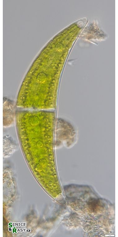 Closterium moniliferum