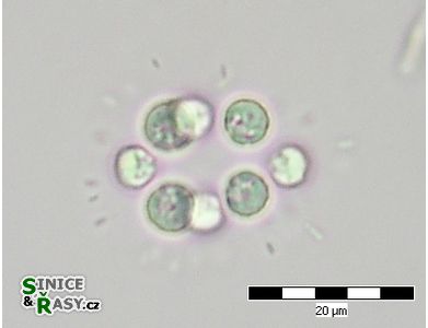 Radiococcus wildermannii