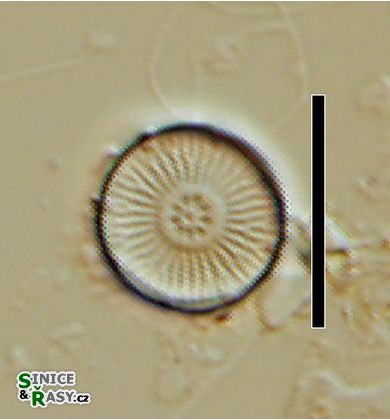 Discostella