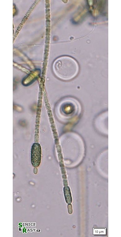 Cylindrospermum stagnale