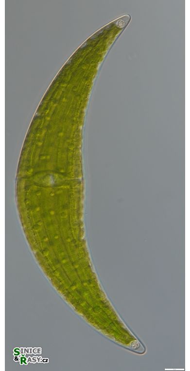 Closterium submoniliferum