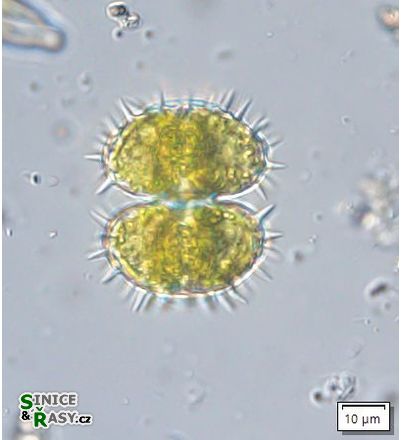 Staurastrum teliferum