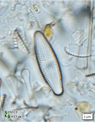 Luticola suecorum