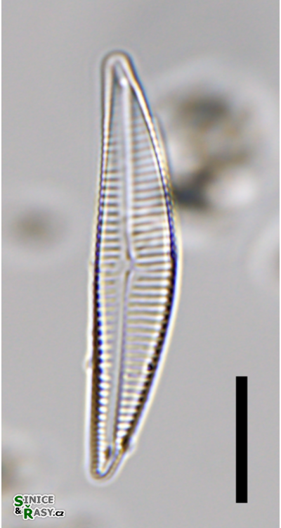 Encyonema neogracile