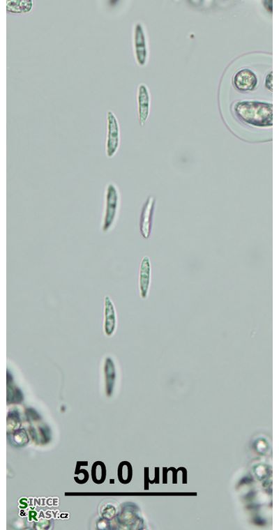 Elakatothrix genevensis