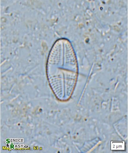 Luticola mutica