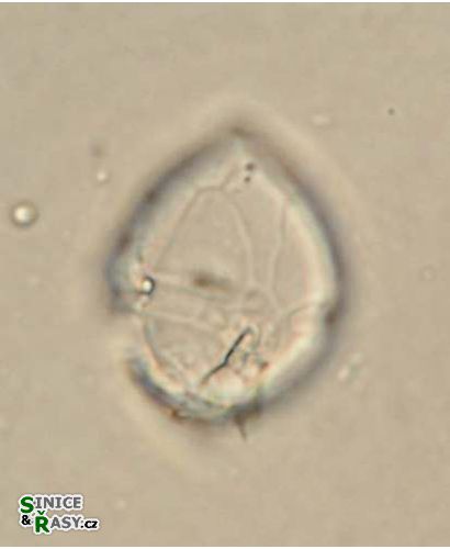 Peridinium umbonatum