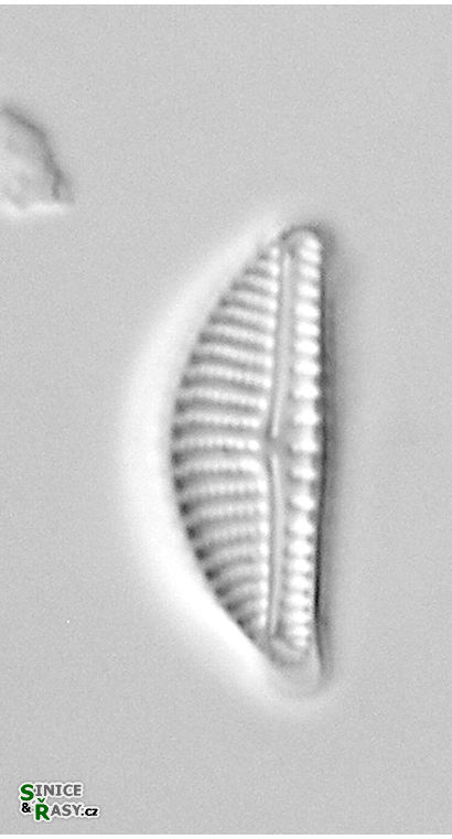 Encyonema silesiacum