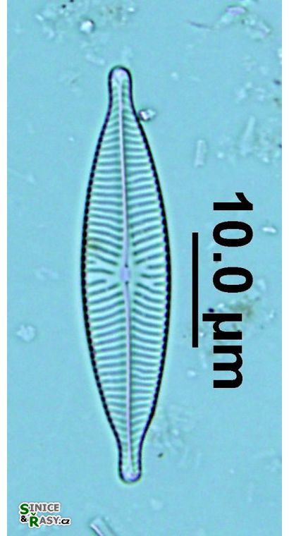 Navicula capitatoradiata
