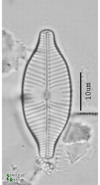 Placoneis explanata