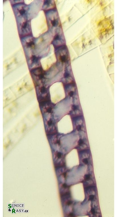 Zygnema