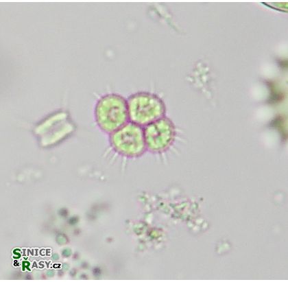 Tetrastrum staurogeniaeforme