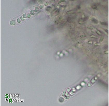 Hydrurus foetidus