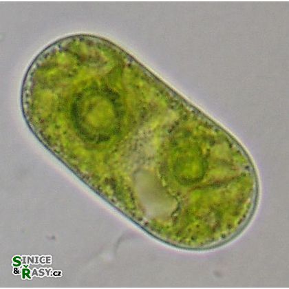Cylindrocystis brebissonii