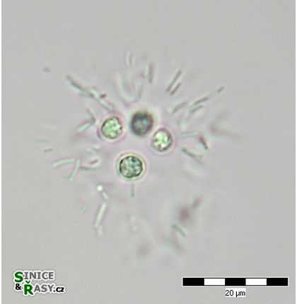Radiococcus wildermannii