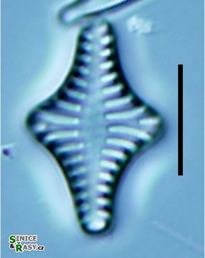 Staurosirella leptostauron