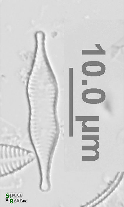 Pseudostaurosira parasitica