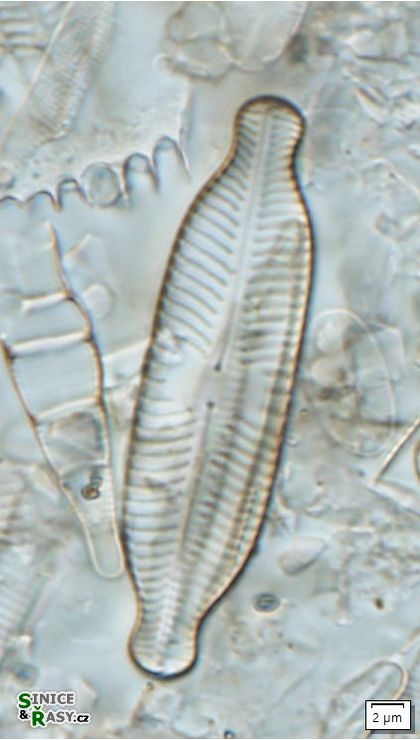 Placoneis elginensis
